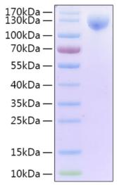 SARS-CoV-2 S1 Protein - Recombinant 2019-nCoV Spike S1 protein on Tris-Bis PAGE under reduced condition. The purity is greater than 95%.