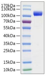 SARS-CoV-2 S1 Protein - Recombinant 2019-nCoV Spike S1 Protein was determined by SDS-PAGE with Coomassie Blue, showing a band at 110-130 kDa.