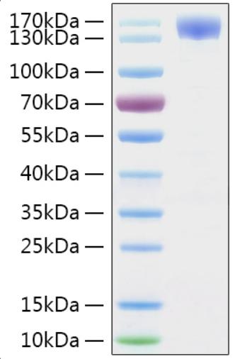 SARS-CoV-2 S1 Protein - Recombinant 2019-nCoV Spike S1 Protein was determined by SDS-PAGE with Coomassie Blue, showing a band at 130-160 kDa.