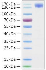 SARS-CoV-2 S1 Protein - Recombinant 2019-nCoV Spike S1 Protein was determined by SDS-PAGE with Coomassie Blue, showing a band at 130-160 kDa.