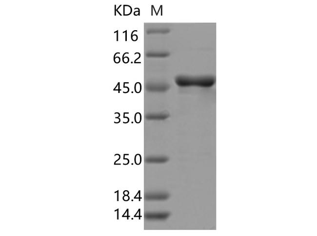 SARS-CoV-2 Nucleoprotein Protein - Recombinant SARS-CoV-2 N Protein (D377Y)(His Tag)
