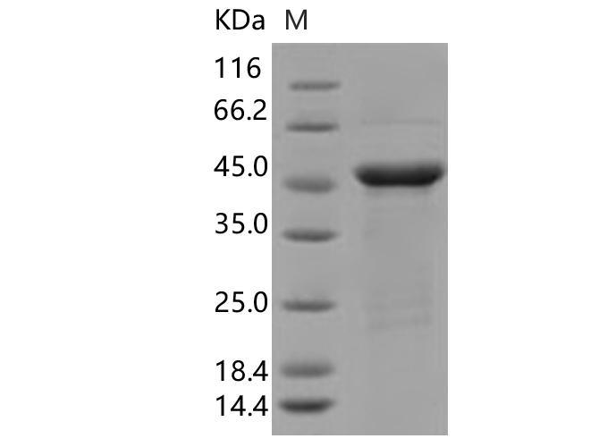 SARS-CoV-2 Nucleoprotein Protein - Recombinant SARS-CoV-2 N Protein (R203K, G204R)(His Tag)