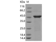 SARS-CoV-2 Nucleoprotein Protein - Recombinant SARS-CoV-2 N Protein (R203K, G204R)(His Tag)