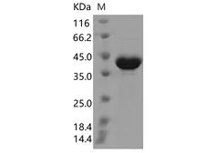 SARS-CoV-2 Nucleoprotein Protein - Recombinant SARS-CoV-2 N Protein (T205I)(His Tag)