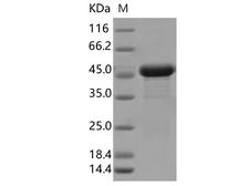 SARS-CoV-2 Nucleoprotein Protein - Recombinant SARS-CoV-2 N Protein (I292T)(His Tag)
