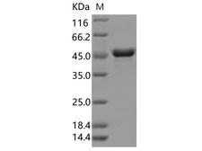 SARS-CoV-2 Nucleoprotein Protein - Recombinant SARS-CoV-2 N Protein (E378Q)(His Tag)