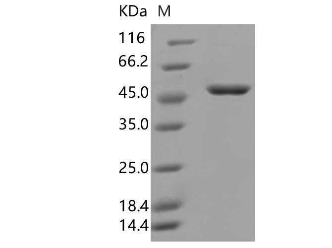 SARS-CoV-2 Nucleoprotein Protein - Recombinant SARS-CoV-2 N Protein (D3L,R203K,G204R,S235F)(His Tag)