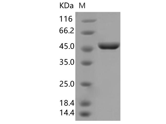 SARS-CoV-2 Nucleoprotein Protein - Recombinant SARS-CoV-2 N Protein (D3L,S235F)(His Tag)