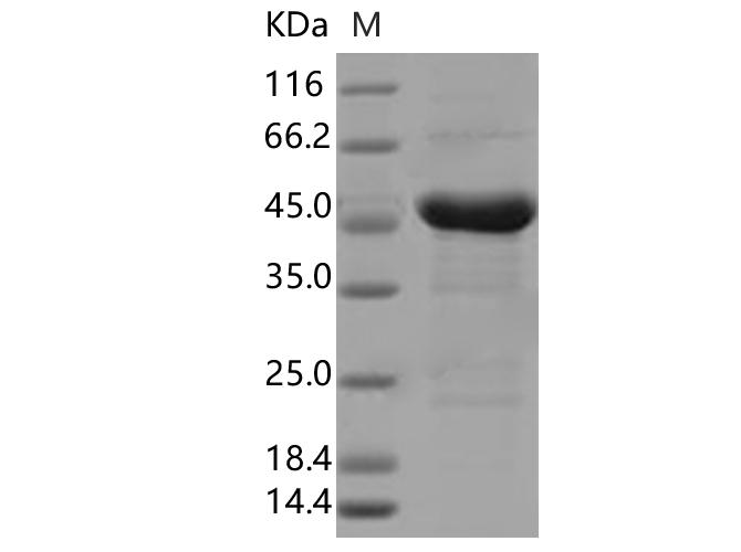 SARS-CoV-2 Nucleoprotein Protein - Recombinant SARS-CoV-2 N Protein (S194L)(His Tag)