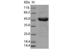 SARS-CoV-2 Nucleoprotein Protein - Recombinant SARS-CoV-2 N Protein (S194L)(His Tag)