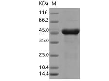 SARS-CoV-2 Nucleoprotein Protein - Recombinant SARS-CoV-2 N Protein (P13L)(His Tag)