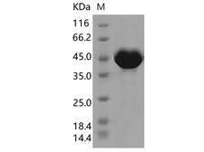 SARS-CoV-2 Nucleoprotein Protein - Recombinant SARS-CoV-2 N Protein (P80R)(His Tag)