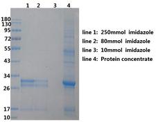 SARS-CoV-2 Nucleoprotein Protein