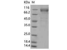 SARS-CoV-2 S1 Protein - Recombinant SARS-CoV-2 Spike S1(E154K, L452R, E484Q, D614G, P681R)(His Tag)