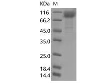 SARS-CoV-2 S1 Protein - Recombinant SARS-CoV-2 Spike S1(W152C, L452R, D614G)(His Tag)