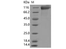 SARS-CoV-2 S1 Protein - Recombinant SARS-CoV-2 Spike S1(?HV69-70, ?Y144, N501Y, A570D, D614G, P681H)(His Tag)