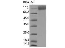 SARS-CoV-2 S1 Protein - Recombinant SARS-CoV-2 Spike S1(?HV69-70,?Y144,N501Y,A570D,D614G,P681H)(His Tag),Biotinylated