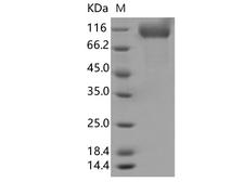 SARS-CoV-2 S1 Protein - Recombinant SARS-CoV-2 Spike S1(?HV69-70,N501Y,D614G)(His Tag)