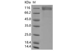 SARS-CoV-2 S1 Protein - Recombinant SARS-CoV-2 Spike S1(K417N, E484K, N501Y, D614G)(His Tag)