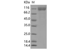 SARS-CoV-2 S1 Protein - Recombinant SARS-CoV-2 Spike S1 (L18F, T20N, P26S, D138Y, R190S, K417T, E484K, N501Y, D614G, H655Y)(His Tag)