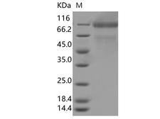 SARS-CoV-2 S1 Protein - Recombinant SARS-CoV-2 Spike S1(T20N, D614G)(His Tag)