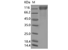 SARS-CoV-2 S1 Protein - Recombinant SARS-CoV-2 Spike S1(A222V, D614G)(His Tag)