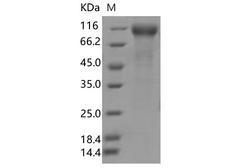 SARS-CoV-2 S1 Protein - Recombinant SARS-CoV-2 Spike S1(?HV69-70, N439K, D614G)(His Tag)