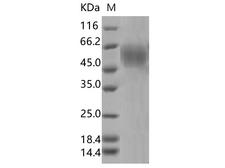 SARS-CoV-2 S1 Protein - Recombinant SARS-CoV-2 Spike S1 NTD (L18F, D80A, D215G, ?LAL242-244, R246I)(His Tag)