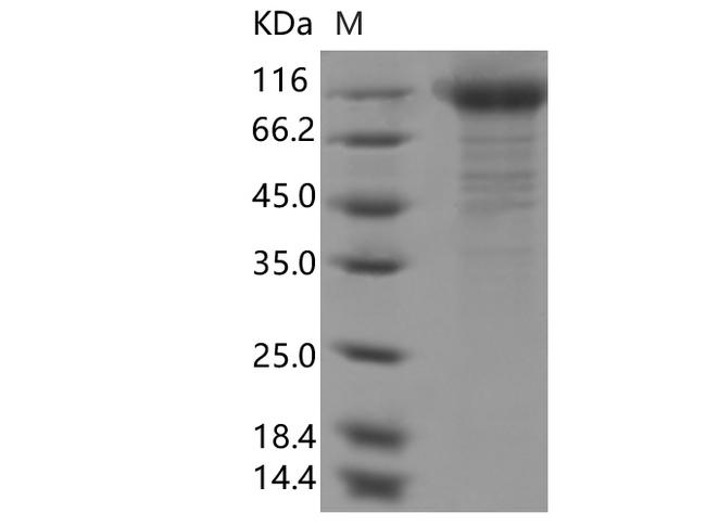 SARS-CoV-2 S1 Protein - Recombinant SARS-CoV-2 Spike S1(N234Q)(His Tag)