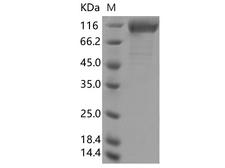 SARS-CoV-2 S1 Protein - Recombinant SARS-CoV-2 Spike S1(?HV69-70, Y453F, D614G)(His Tag)
