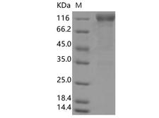 SARS-CoV-2 S1 Protein - Recombinant SARS-CoV-2 Spike S1(D614G),ECD(Fc Tag)