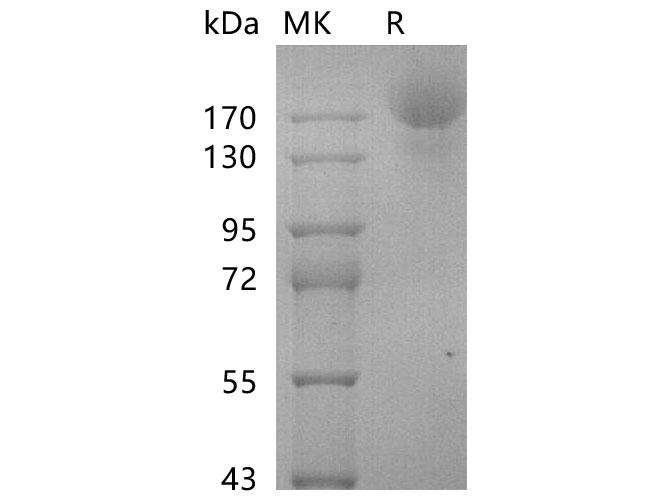 SARS-CoV-2 Spike Glycoprotein Protein - Recombinant SARS-CoV-2 S-stable trimer Protein (C-6His)(Active)