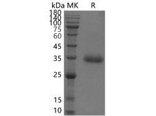 SARS-CoV-2 Spike Glycoprotein Protein - Recombinant SARS-CoV-2 Spike RBD(E484K, K417T, N501Y)(His Tag)