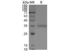 SARS-CoV-2 Spike Glycoprotein Protein - Recombinant SARS-CoV-2 Spike RBD(L452R)(His Tag)