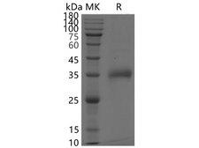 SARS-CoV-2 Spike Glycoprotein Protein - Recombinant SARS-CoV-2 Spike RBD(K417N,E484K,N501Y)(His Tag)