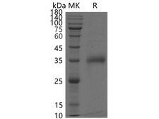 SARS-CoV-2 Spike Glycoprotein Protein - Recombinant SARS-CoV-2 Spike RBD(E484K)(His Tag)