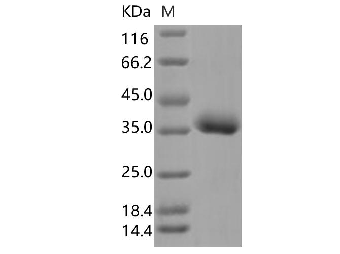 SARS-CoV-2 Spike Glycoprotein Protein - Recombinant SARS-CoV-2 Spike RBD (L452R, E484Q)(His Tag)