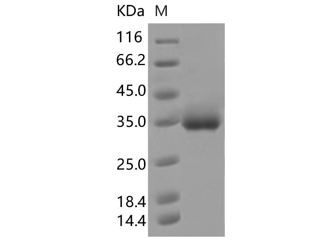 SARS-CoV-2 Spike Glycoprotein Protein - Recombinant SARS-CoV-2 Spike RBD(S494P)(His Tag)