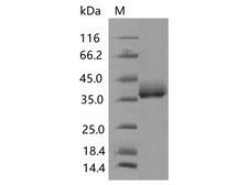SARS-CoV-2 Spike Glycoprotein Protein - Recombinant SARS-CoV-2 Spike RBD(N501Y)(His Tag), Biotinylated