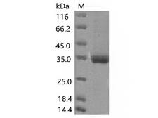 SARS-CoV-2 Spike Glycoprotein Protein - Recombinant SARS-CoV-2 Spike RBD(K417N)(His Tag)