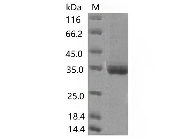 SARS-CoV-2 Spike Glycoprotein Protein - Recombinant SARS-CoV-2 Spike RBD(K417N)(His Tag)