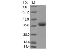 SARS-CoV-2 Spike Glycoprotein Protein - Recombinant SARS-CoV-2 Spike RBD(K417N)(His Tag), Biotinylated