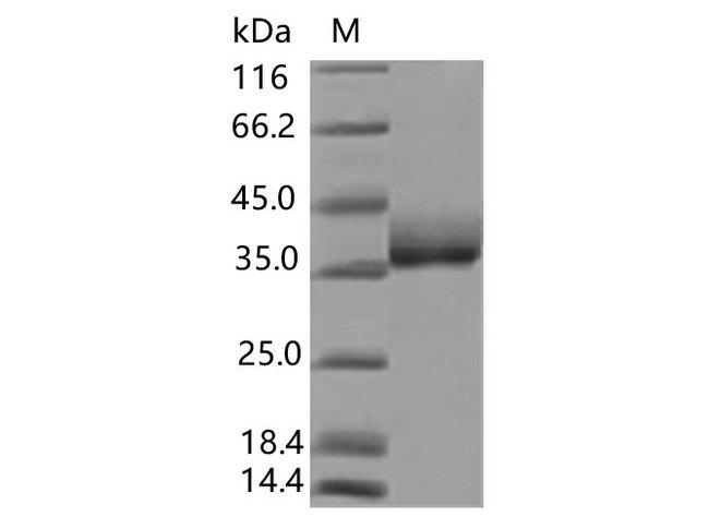 SARS-CoV-2 Spike Glycoprotein Protein - Recombinant SARS-CoV-2 Spike RBD(K417N, E484K, N501Y)(His Tag), Biotinylated