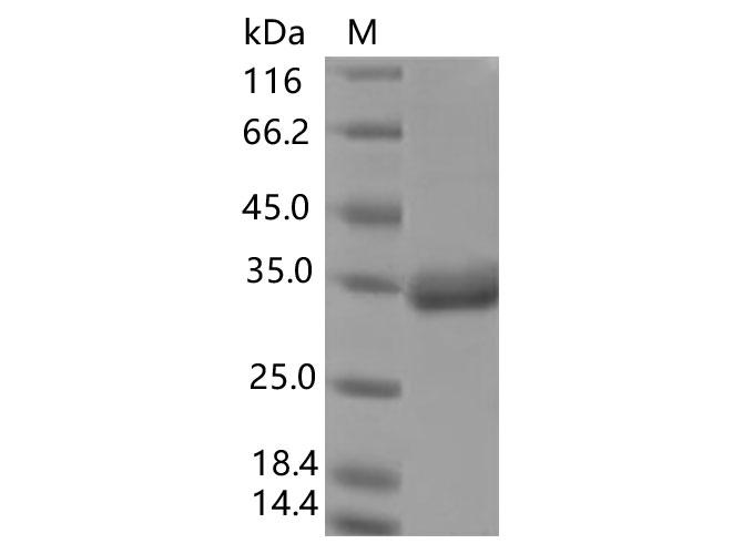 SARS-CoV-2 Spike Glycoprotein Protein - Recombinant SARS-CoV-2 Spike RBD(E484K)(His Tag), Biotinylated