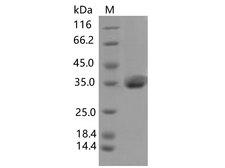 SARS-CoV-2 Spike Glycoprotein Protein - Recombinant SARS-CoV-2 Spike RBD(K417N, E484K, N501Y)(His Tag)