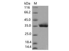 SARS-CoV-2 Spike Glycoprotein Protein - Recombinant SARS-CoV-2 Spike RBD(Y453F)(His Tag)