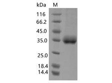 SARS-CoV-2 Spike Glycoprotein Protein - Recombinant SARS-CoV-2 Spike RBD (K417T, E484K, N501Y)(His Tag)