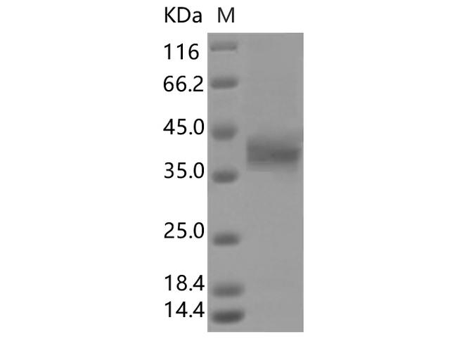 SARS-CoV-2 Spike Glycoprotein Protein - Recombinant SARS-CoV-2 Spike RBD(A372S)(His Tag)