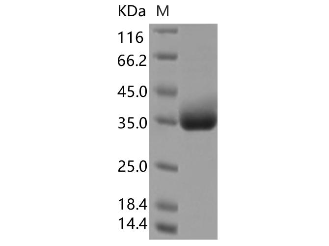 SARS-CoV-2 Spike Glycoprotein Protein - Recombinant SARS-CoV-2 Spike RBD(A522S)(His Tag)