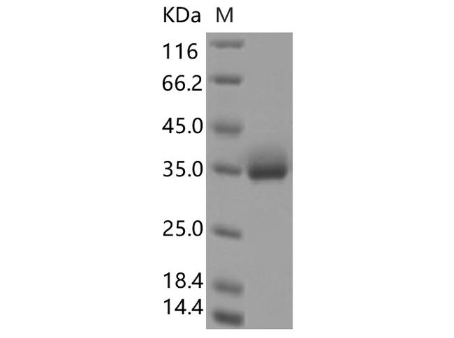 SARS-CoV-2 Spike Glycoprotein Protein - Recombinant SARS-CoV-2 Spike RBD(A520S)(His Tag)